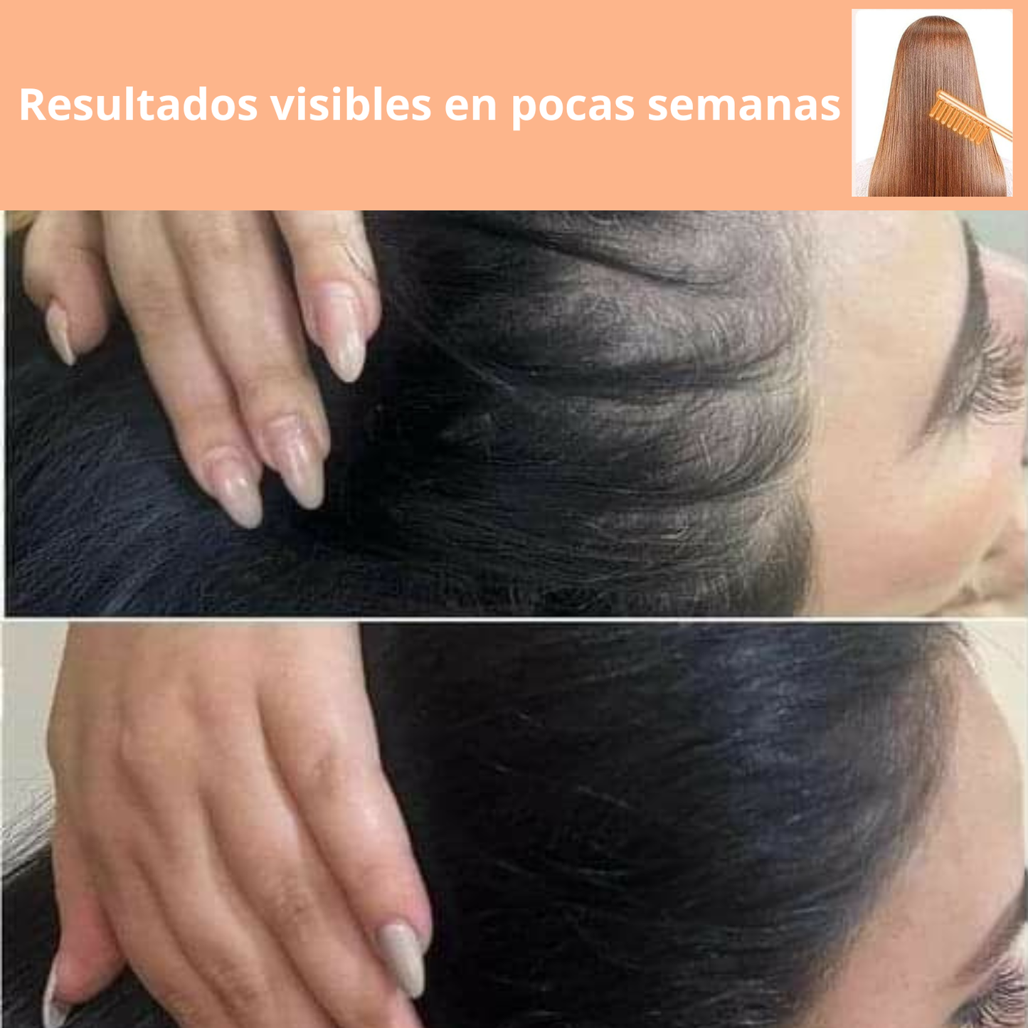 Terapia Estética de Alta Frecuencia