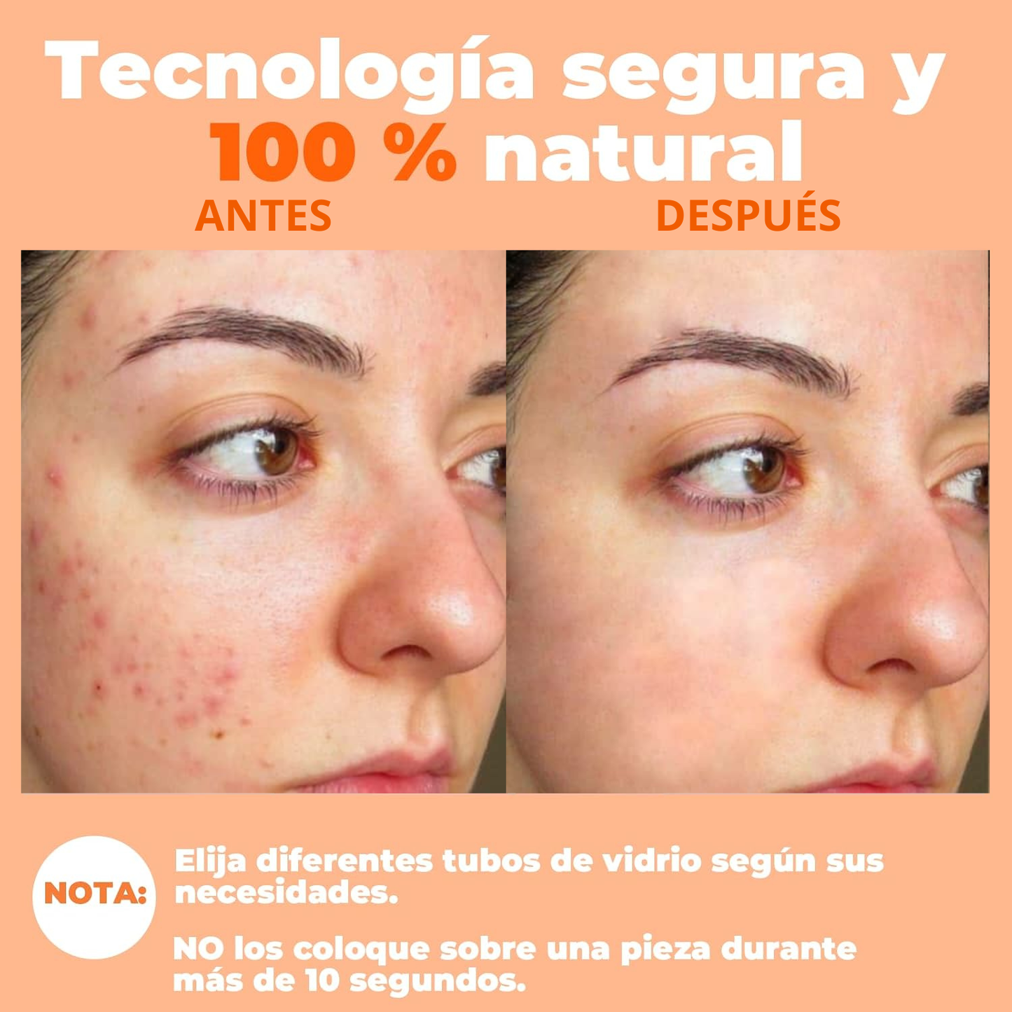 Terapia Estética de Alta Frecuencia